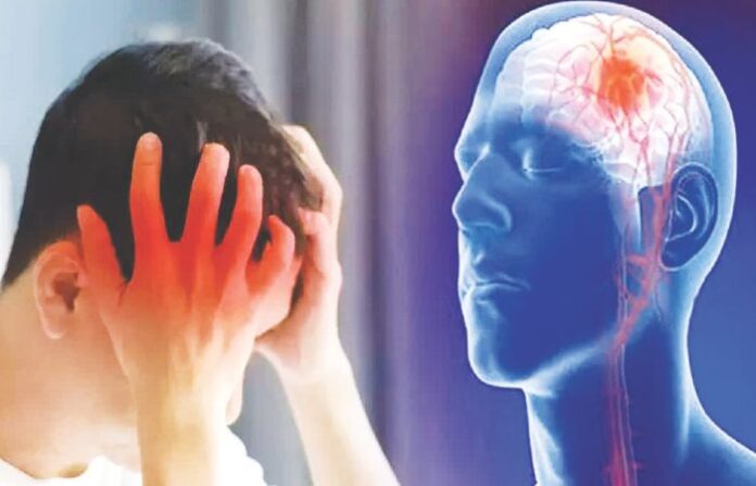 Brain