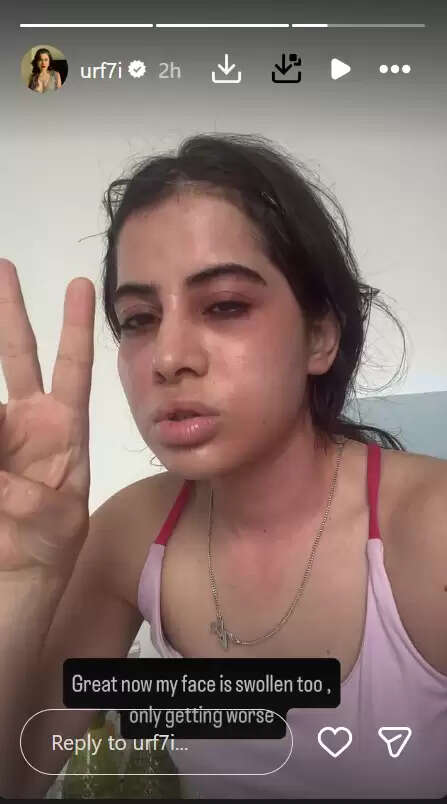 उर्फी जावेदच्या आरोग्याची चिंता: चाहत्यांनी तणाव वाढविला