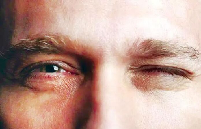 eye twitching