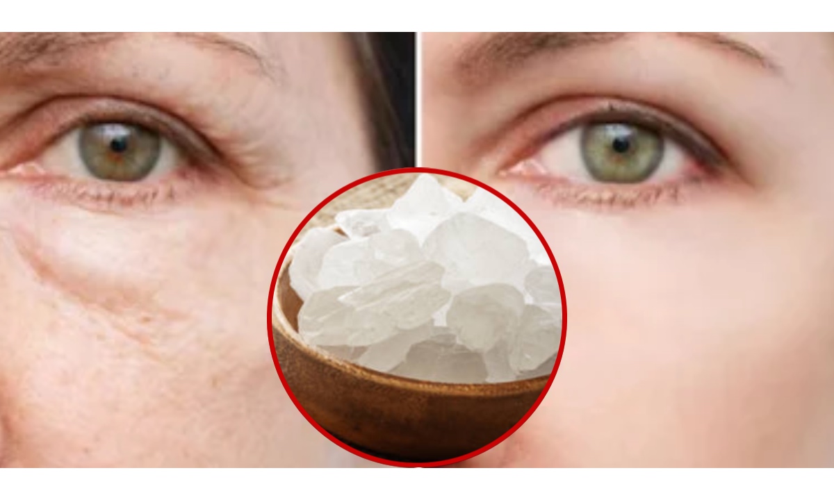 गडद डागांसाठी तुरटी